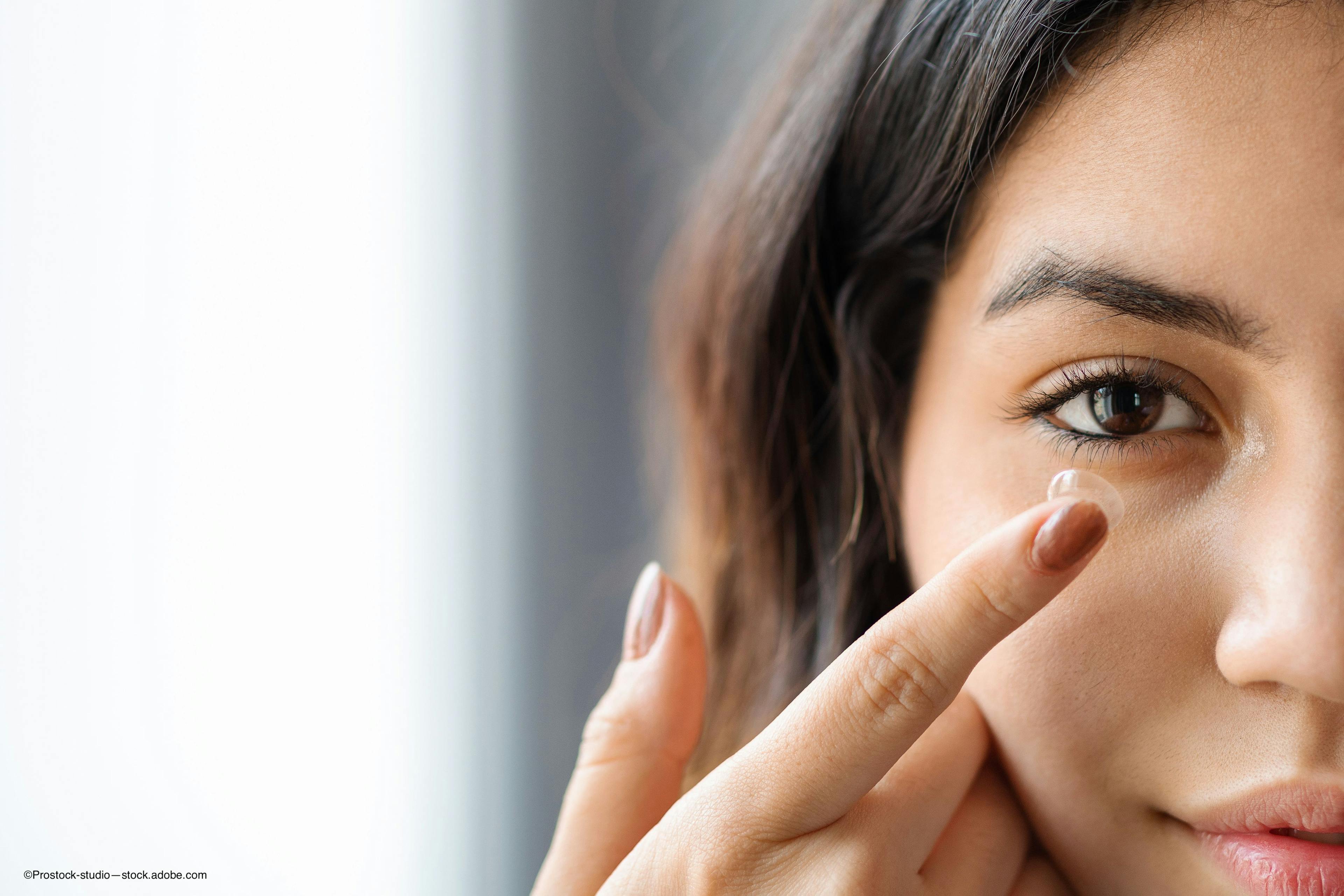 woman inserting contact lens optometry news - ©Prostock-studio