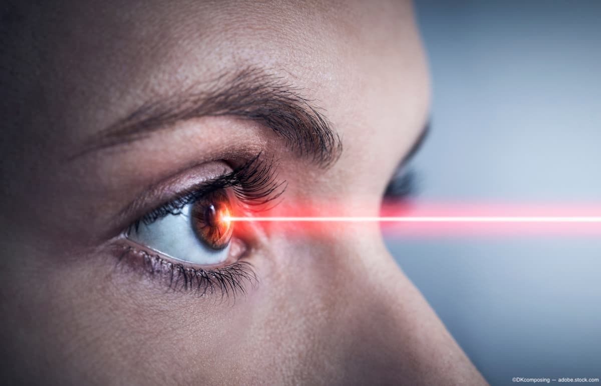 Red laser beaming into eye Image Credit: AdobeStock/DKcomposing