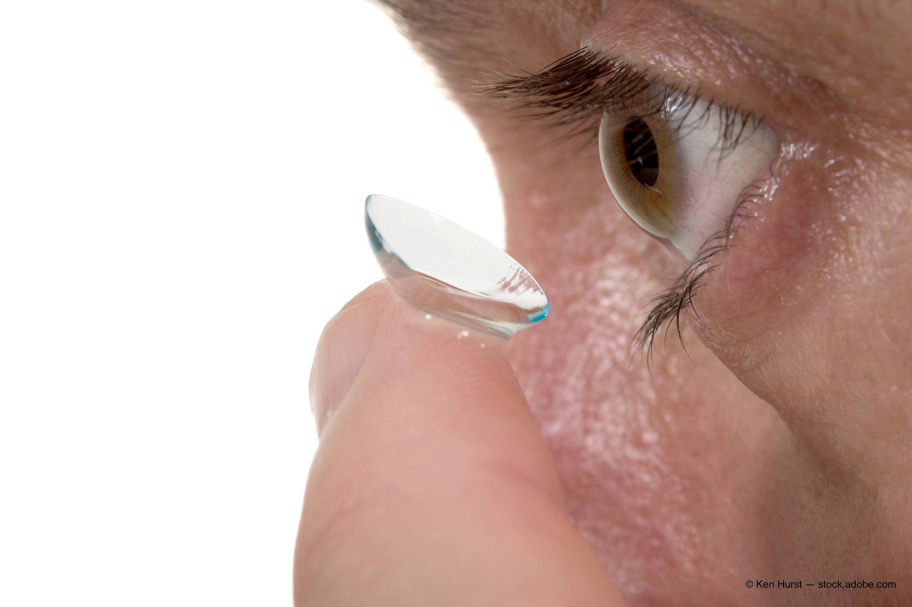 person inserting contact lens