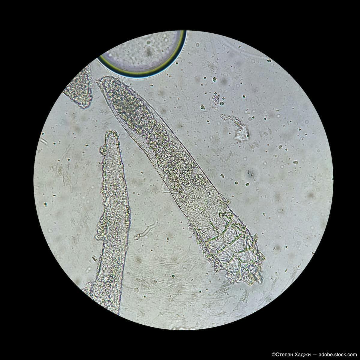 Microscopal image of Demodex mites Image Credit: ©Степан Хаджи - adobe.stock.com