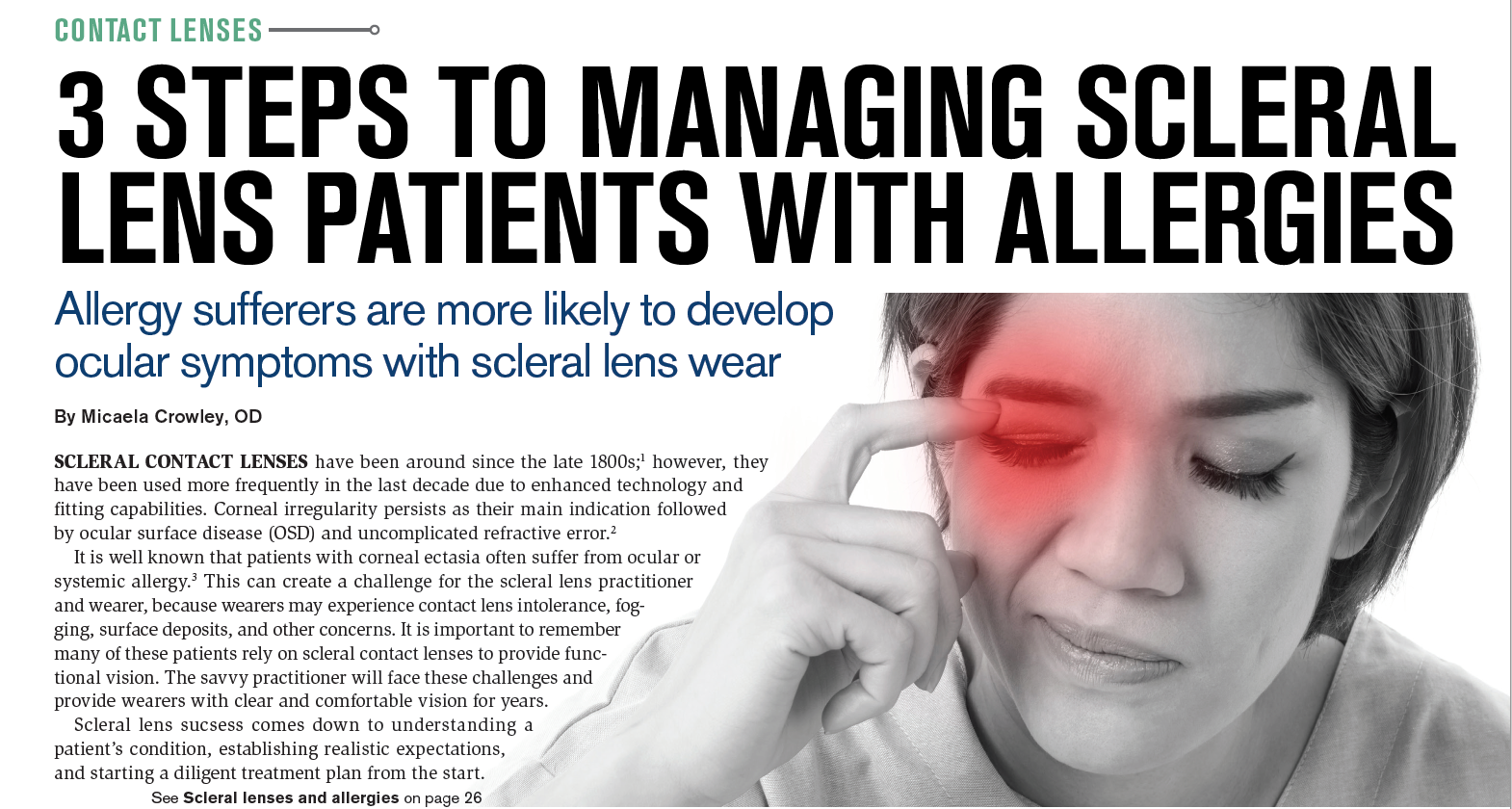 3 steps to managing scleral lens patients with allergies