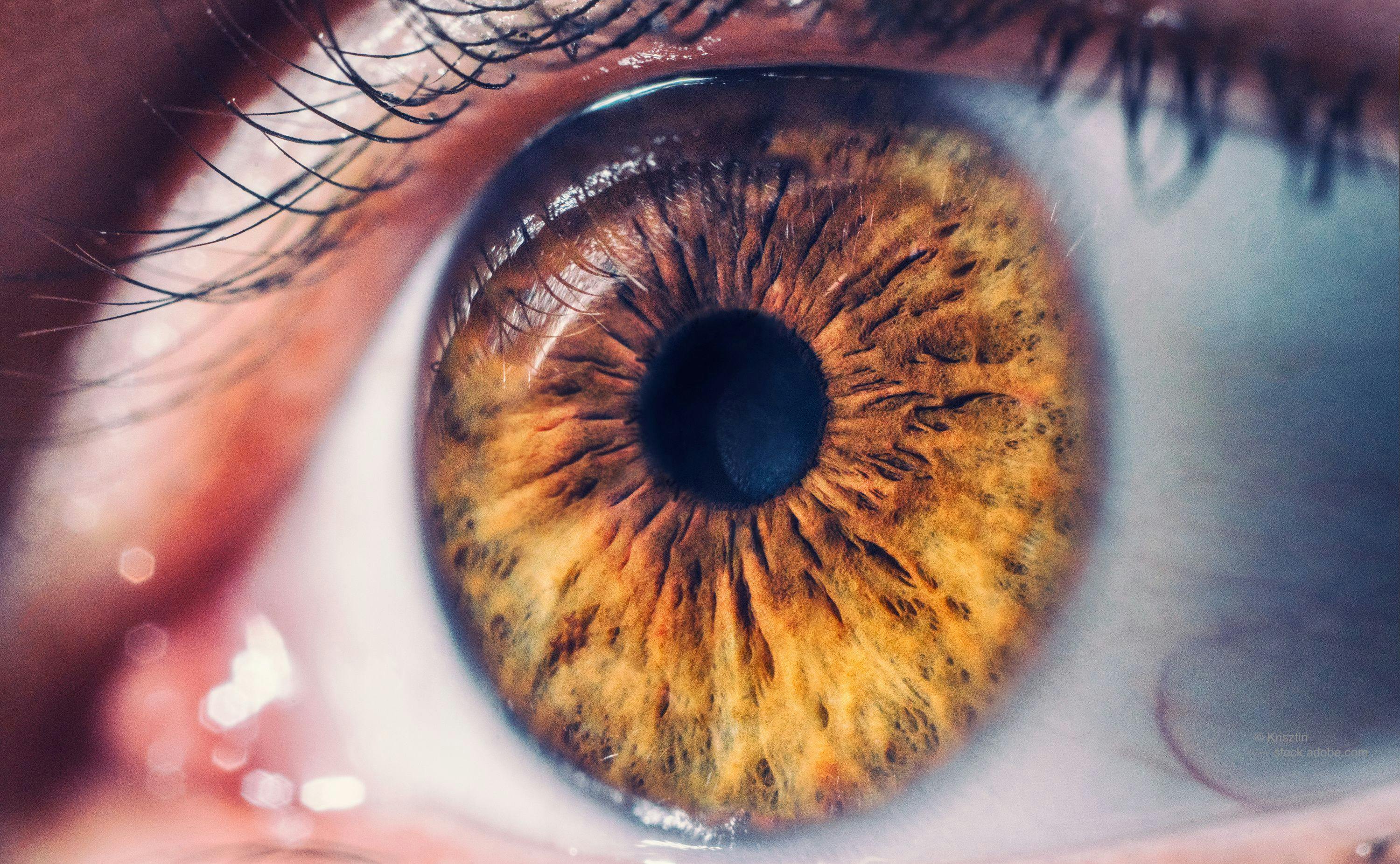 the risk of 5-letter visual acuity (VA) loss at 24 months for eyes with clinically significant diabetic macular edema (CSDME) and good VA initially treated and eyes that were initially observed in routine clinical practice are correlated.