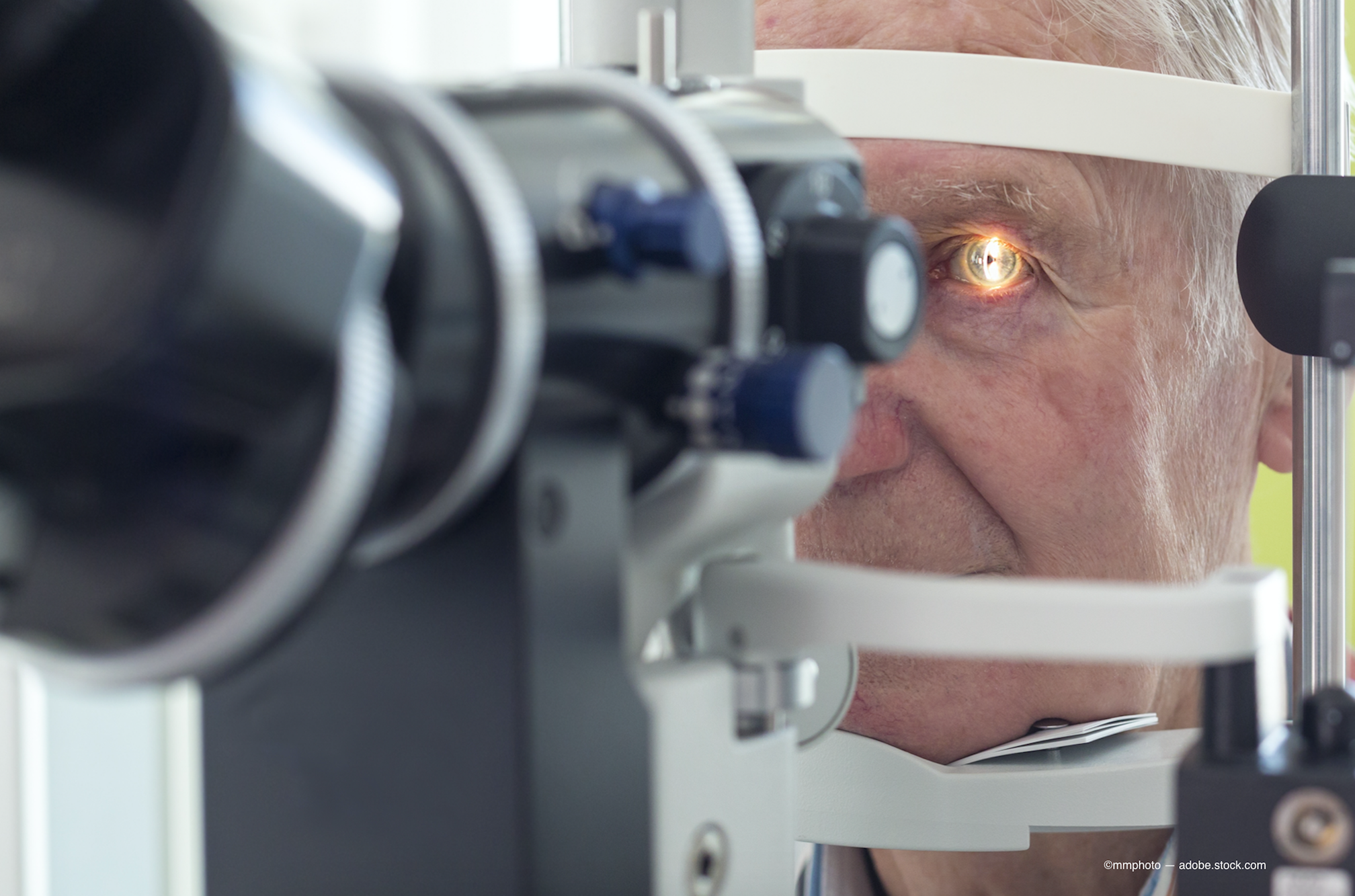 5 steps to manage cataract patient expectations