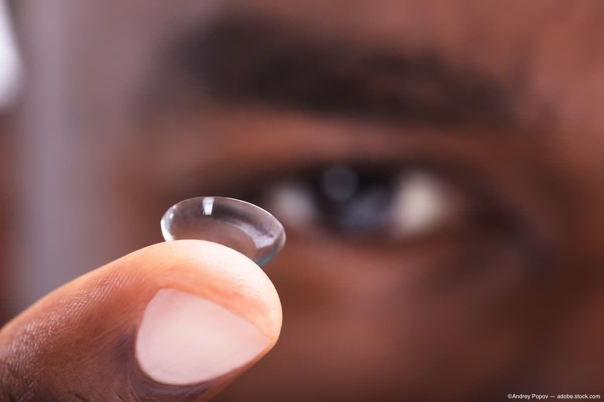 Closeup of contact lens on finger in front of face Image Credit: AdobeStock/AndreyPopov