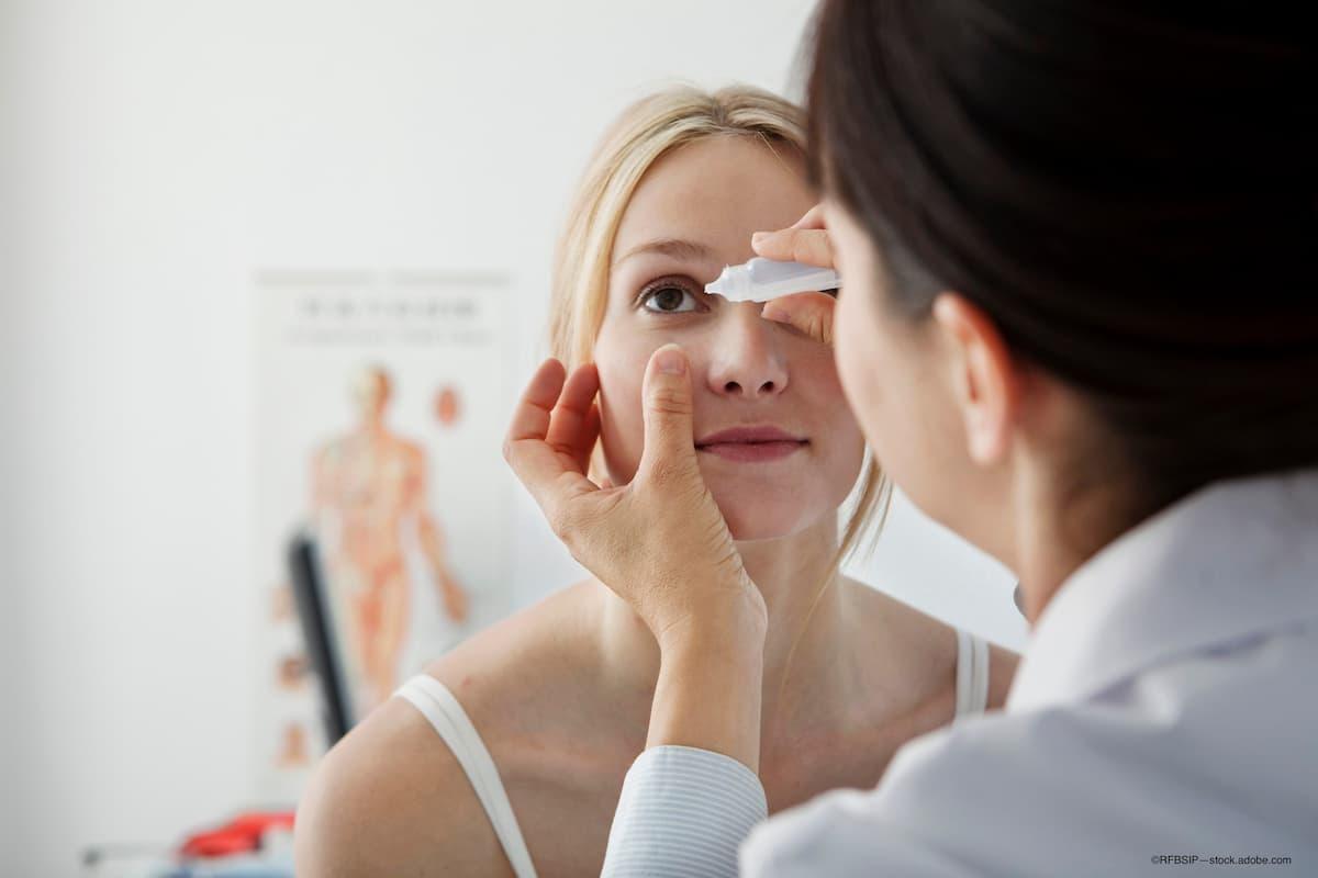 woman receives perfluorohexyloctane drops during the Kalahari trial for DED - Image credit: Adobe Stock/©RFBSIP