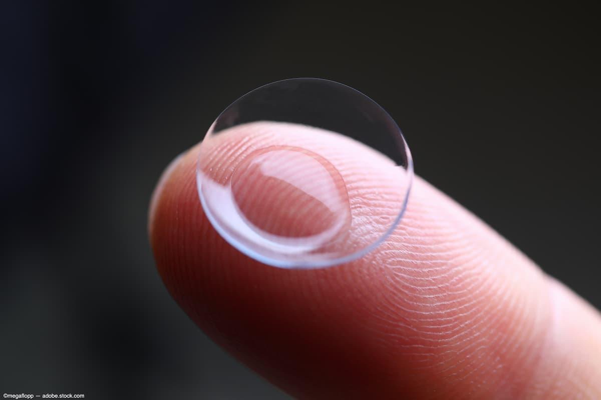 Contact lens on finger Image credit: AdobeStock/megaflopp