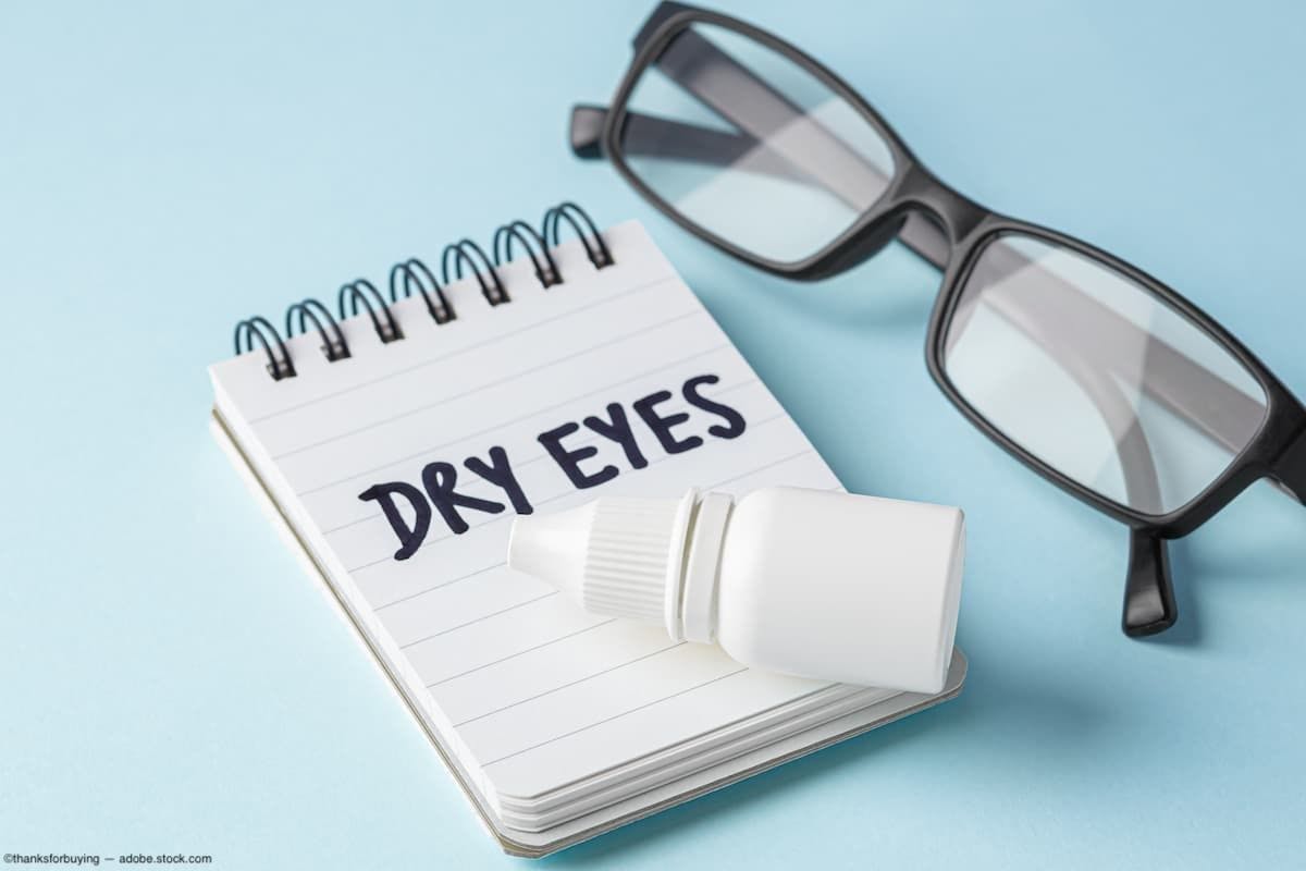 Eye drops laying on notebook with "DRY EYES" written on the page Image credit: ©thanksforbuying - adobe.stock.com