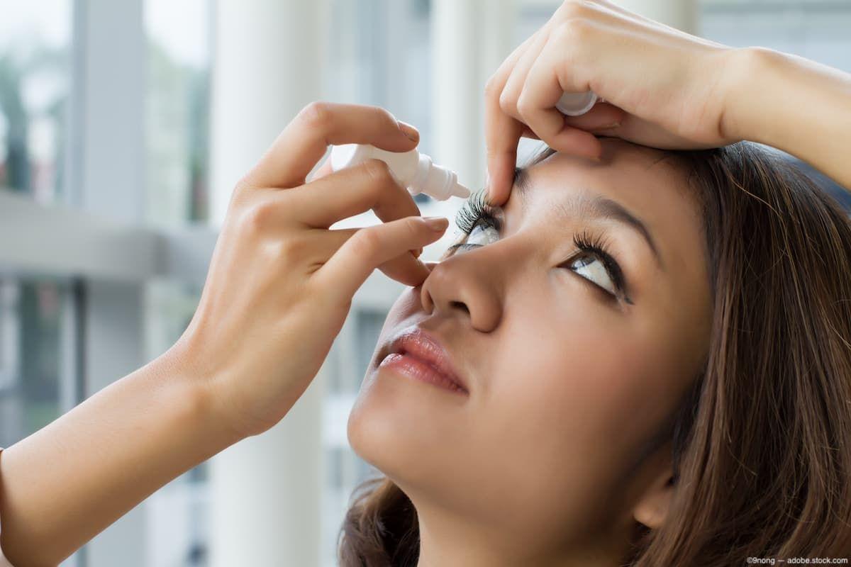 Woman administering eye drops Image credit: AdobeStock/9nong