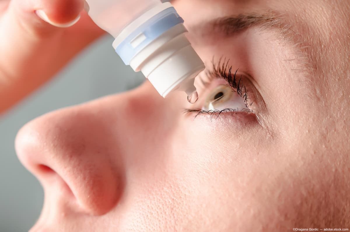 Woman applying eye drops into eye Image credit: ©Dragana Gordic - adobe.stock.com