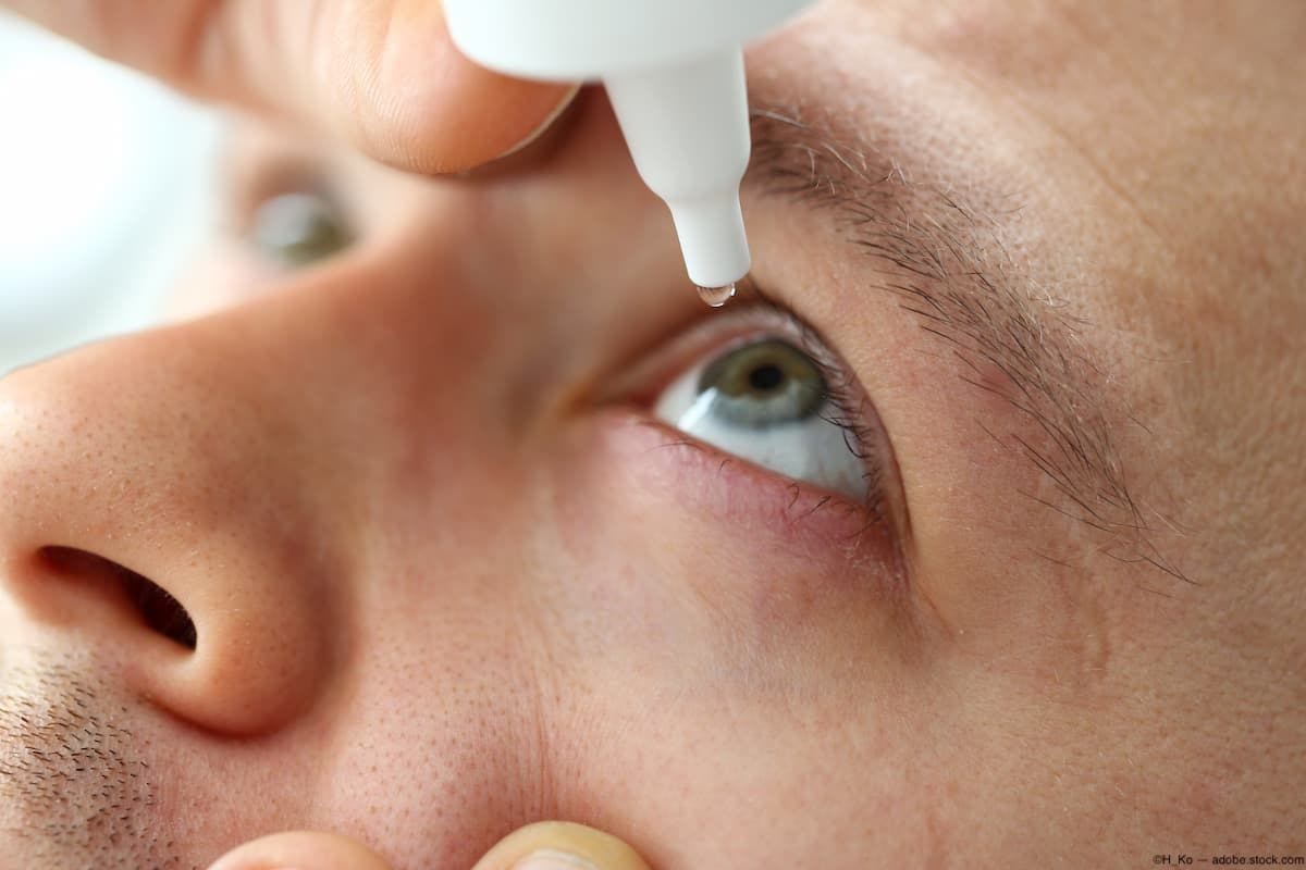 Closeup of man administering eye drops into eye Image credit: AdobeStock/H_Ko