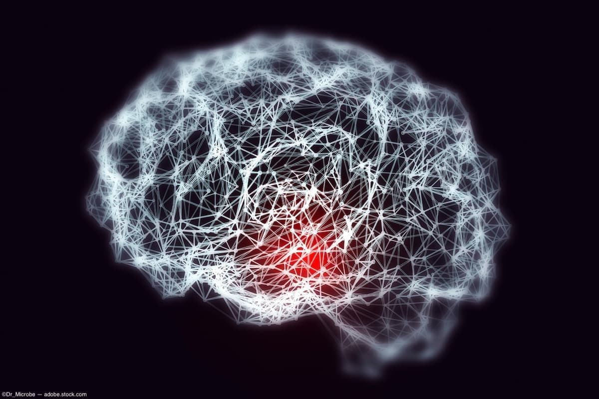 Graphic of brain affected by Alzheimer disease Image credit: AdobeStock/Dr_Microbe