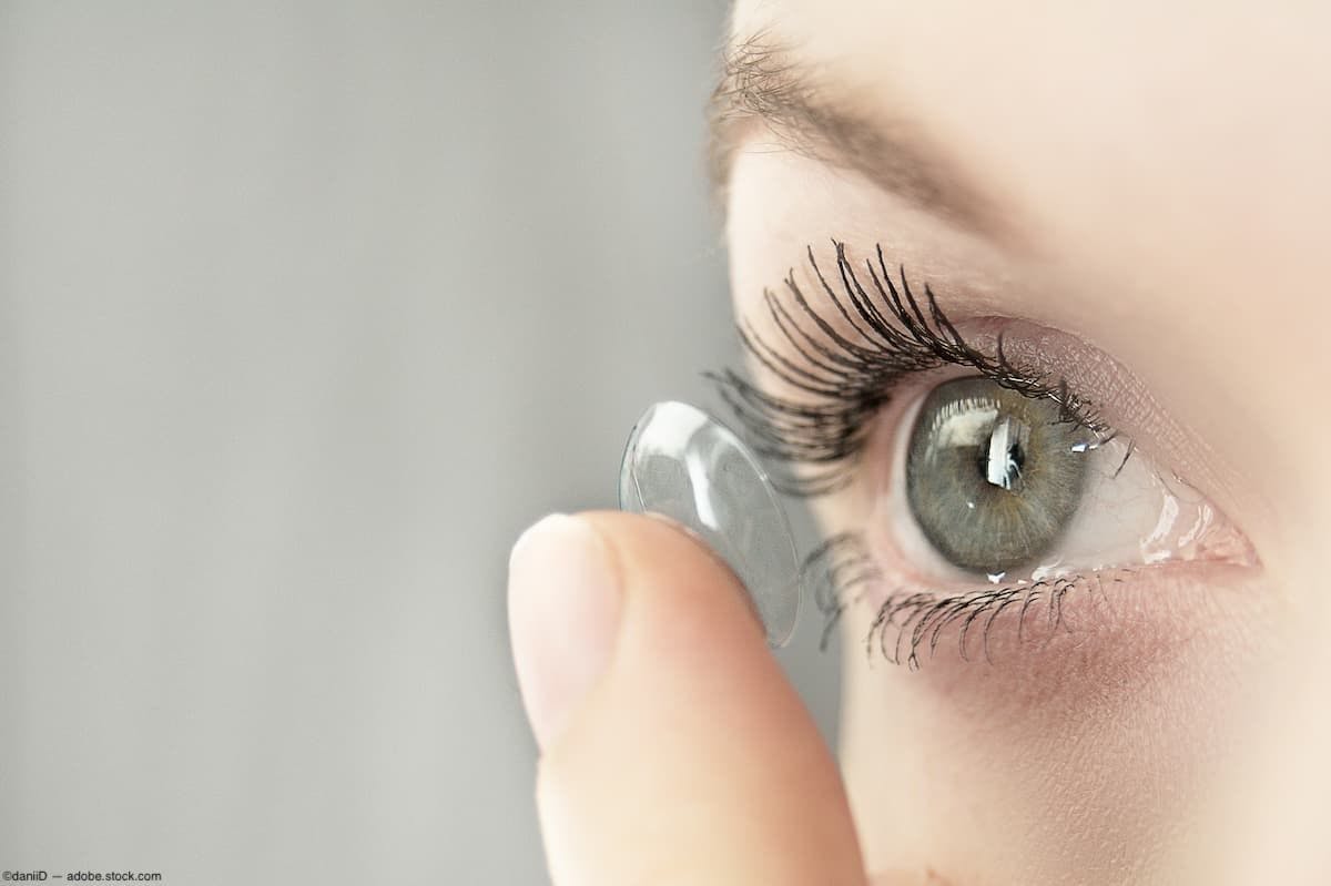 Closeup of contact lens insertion Image Credit: AdobeStock/daniiD