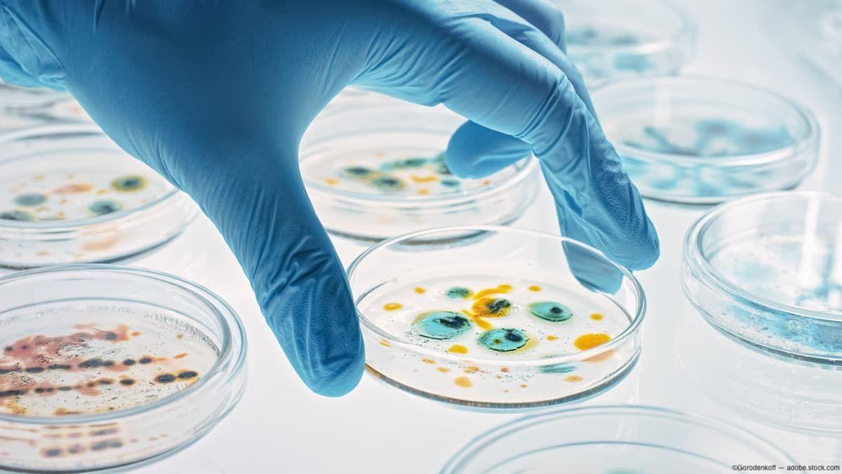 Gloved hand picking up petri dish with bacteria Image credit: AdobeStock/Gorodenkoff