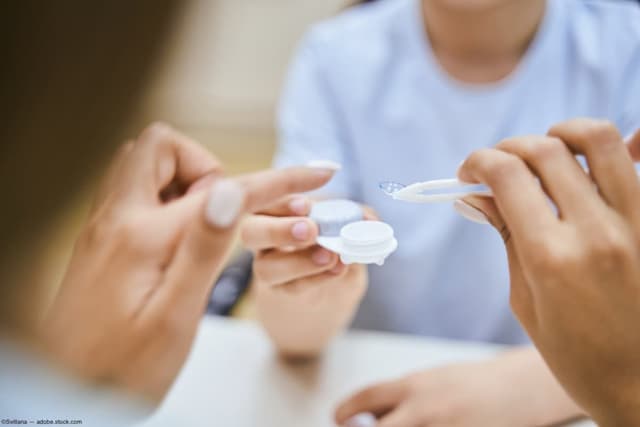 Contact lenses demonstrated to patient Image credit: AdobeStock/Svitlana