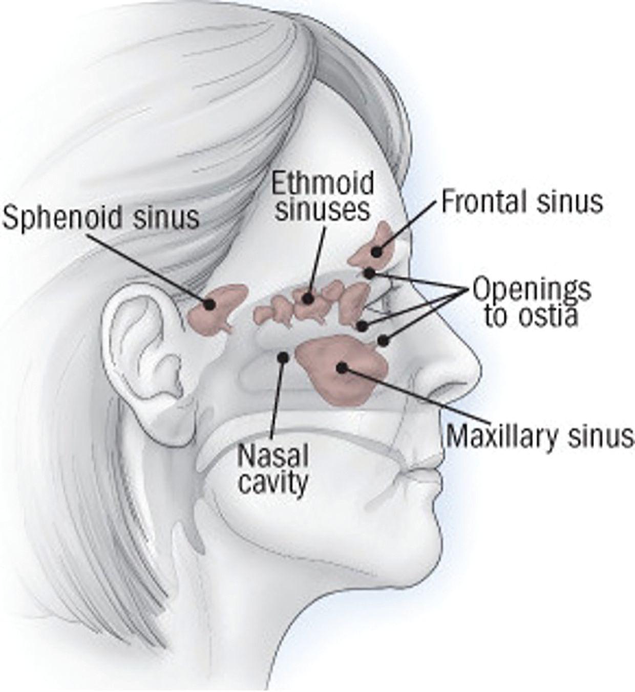 The location of maxillary, frontal, sphenoid, and ethmoid paranasal sinuses.  (Image courtesy of health.harvard.edu)