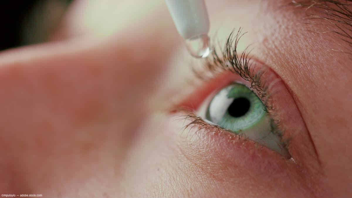 Eye drop adminsitration Image credit: AdobeStock/mputsylo