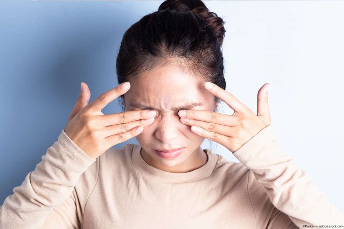 Woman rubbing both her eyes Image credit: ©Parkin - adobe.stock.com