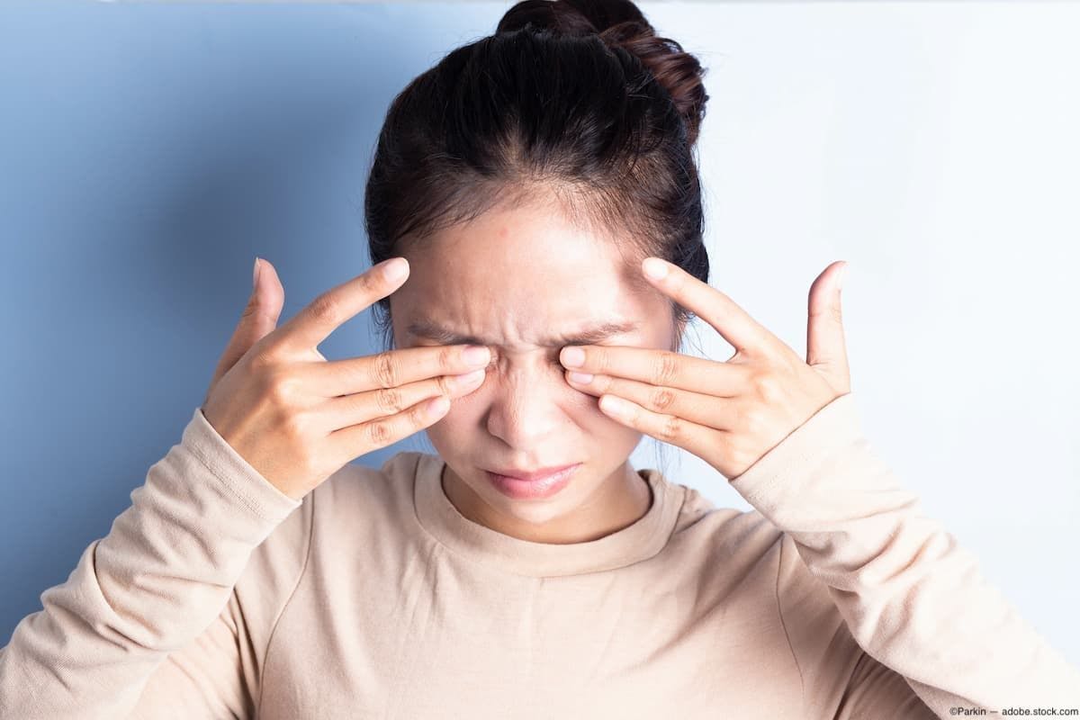 Woman rubbing both her eyes Image credit: AdobeStock/Parkin