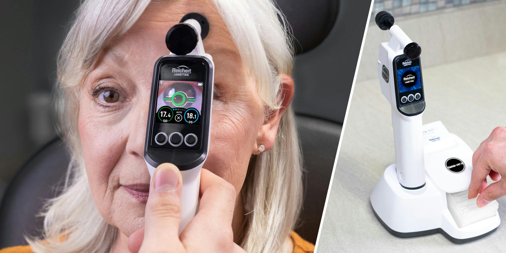 Physician using tonometer on patient's eye Image credit: Reichert Technologies