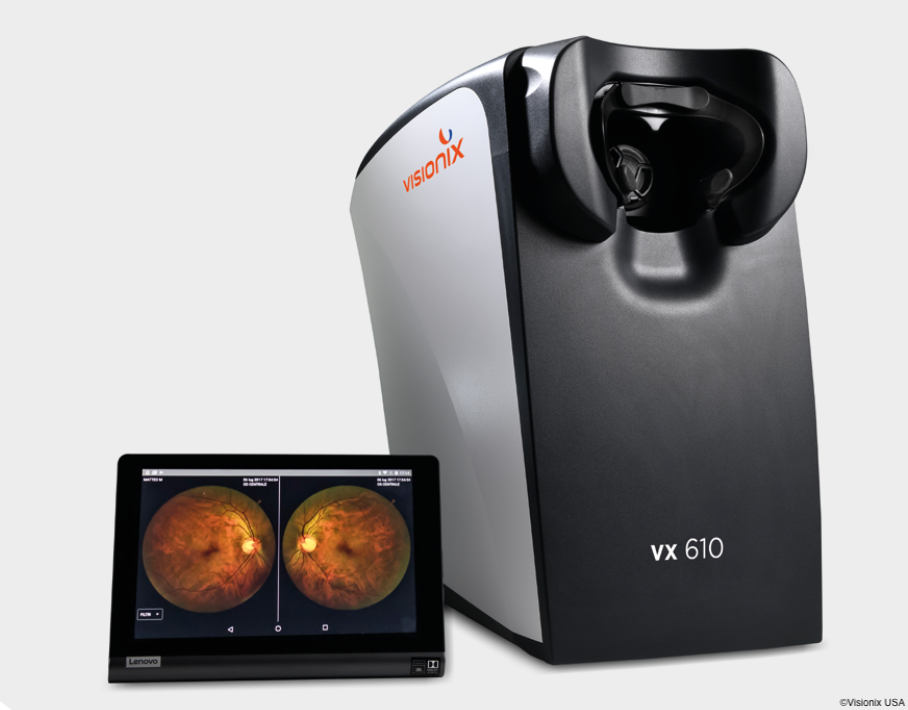 VX 610 fundus camera with retinal images Image credit: Visionix USA